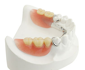 partial dentures